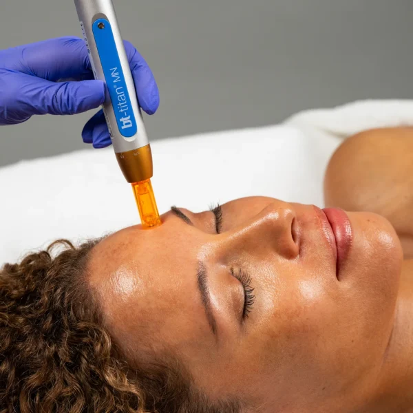 bt titan Dermapen sustav napredne mikroeksfoliacije mikro hr 02