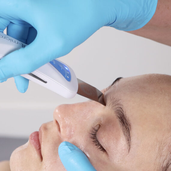 bt-micro-fusion-PRO-ultrazvucna-spatula-mikro-hr-shop-za-kozmeticke-salone-profesionalnu-opremu-zagreb-5