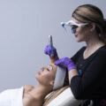 bt-titan®-MN-dermapen-za-mikro-piling-mikro-hr-shop-za-kozmeticke-salone-profesionalnu-opremu-zagreb-3