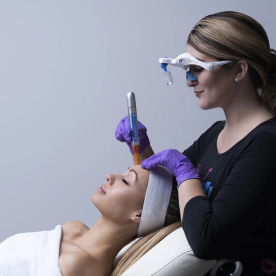 bt-titan®-MN-dermapen-za-mikro-piling-mikro-hr-shop-za-kozmeticke-salone-profesionalnu-opremu-zagreb-3