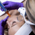 bt-titan®-MN-dermapen-za-mikro-piling-mikro-hr-shop-za-kozmeticke-salone-profesionalnu-opremu-zagreb-4