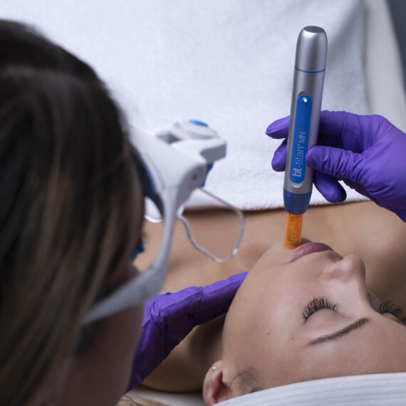 bt-titan®-MN-dermapen-za-mikro-piling-mikro-hr-shop-za-kozmeticke-salone-profesionalnu-opremu-zagreb-8