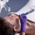 bt-titan®-MN-dermapen-za-mikro-piling-mikro-hr-shop-za-kozmeticke-salone-profesionalnu-opremu-zagreb-9