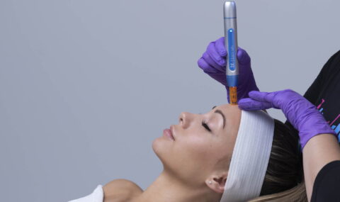 BT-Titan-MN-sustav-mikro-pilinga-mikro-kozmeticka-oprema-5