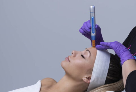 BT-Titan-MN-sustav-mikro-pilinga-mikro-kozmeticka-oprema-5