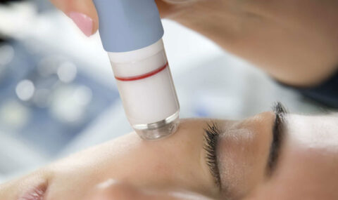 mikrodermoabrazija_blog_novosti_cover_mikrohr_001