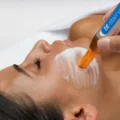 Aquafuse Tech Peel mikro hr- (5)