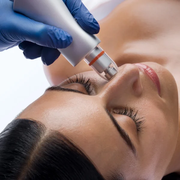 Bio-Brasion GEN4 mokro suha dijamantna mikrodermoabrazija mikro hr 02