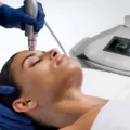 Bio-Brasion GEN4 mokro suha dijamantna mikrodermoabrazija mikro hr 03